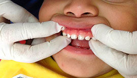 Dentista para niños